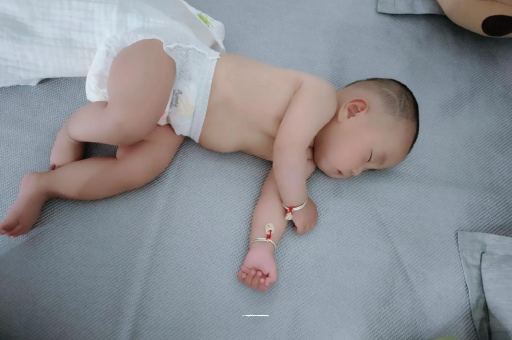 临邑六个月宝宝眼睛散光